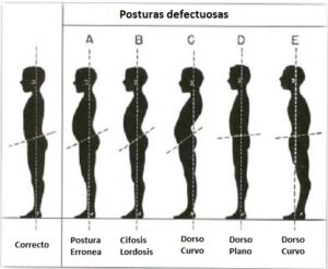 Fuente: http://kinesiologoenlinea.blogspot.com.es/p/reeducacion-postural-global.html